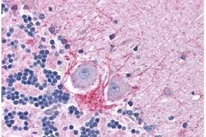 Human Brain, Cerebellum: Formalin-Fixed, Paraffin-Embedded (FFPE) (DNASE1 antibody  (AA 1-252))