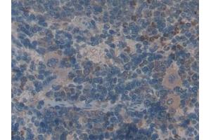 Detection of ANG-3 in Rat Spleen Tissue using Polyclonal Antibody to Angiopoietin-3 (ANG-3) (Angiopoietin 4 antibody  (AA 36-297))