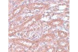 Immunohistochemistry (IHC) image for anti-Ectodermal-Neural Cortex 1 (With BTB-Like Domain) (ENC1) (Middle Region) antibody (ABIN1030924) (ENC1 antibody  (Middle Region))