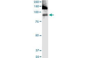ITGB2 monoclonal antibody (M03), clone 3C7. (Integrin beta 2 antibody  (AA 1-769))