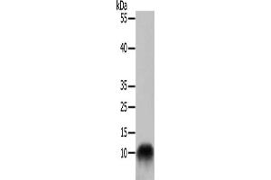 Gel: 10+15 % SDS-PAGE, Lysate: 50 μg, Lane: 293T cells, Primary antibody: ABIN7129018(COX7B Antibody) at dilution 1/700, Secondary antibody: Goat anti rabbit IgG at 1/8000 dilution, Exposure time: 30 seconds (COX7B antibody)