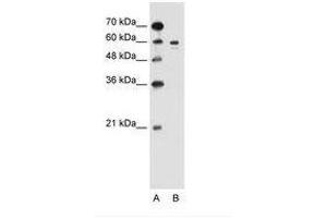 Image no. 1 for anti-Tyrosinase (TYR) (AA 321-370) antibody (ABIN205038) (TYR antibody  (AA 321-370))