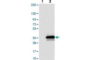 Western blot analysis of Lane 1: Negative control (vector only transfected HEK293T lysate). (BPGM antibody)