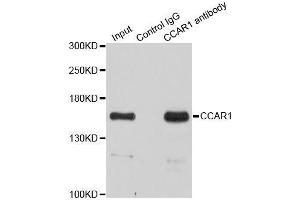 Immunoprecipitation analysis of 200ug extracts of HeLa cells using 3ug CCAR1 antibody.