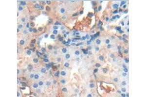 Figure. (Smoothelin antibody  (AA 748-911))