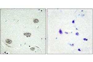 Immunohistochemistry (IHC) image for anti-Colony Stimulating Factor 1 Receptor (CSF1R) (pTyr809) antibody (ABIN7139075)