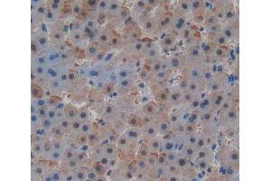 Used in DAB staining on fromalin fixed paraffin- embedded Kidney tissue (MLYCD antibody  (AA 191-493))