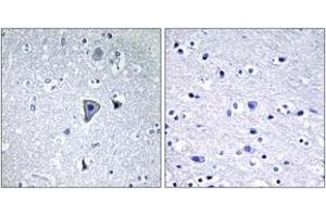 Immunohistochemistry analysis of paraffin-embedded human brain tissue, using GRM1 Antibody. (Metabotropic Glutamate Receptor 1 antibody  (AA 251-300))