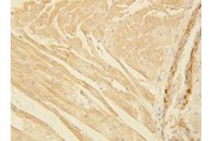 Actin Polyclonal Antibody (Actin antibody  (C-Term, pan))
