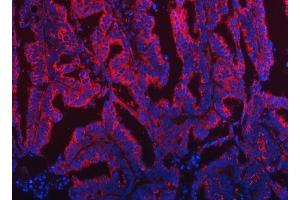 IF analysis of TOM1L1 using anti-TOM1L1 antibody (ABIN7602631).