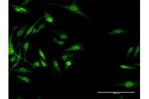 Immunofluorescence of purified MaxPab antibody to CACNB3 on HeLa cell. (CACNB3 antibody  (AA 1-484))