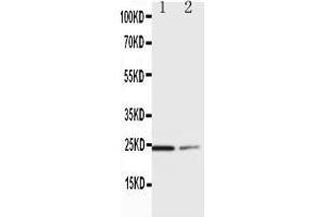 Anti-SOCS1 antibody, Western blotting Lane 1:  Cell Lysate Lane 2: COLO320 Cell Lysate (SOCS1 antibody  (C-Term))