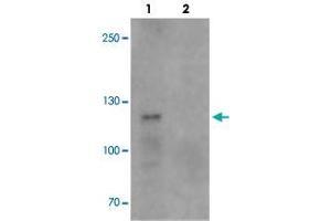 Western blot analysis of TCIRG1 in EL4 cell lysate with TCIRG1 polyclonal antibody  at 0. (TCIRG1 antibody  (N-Term))