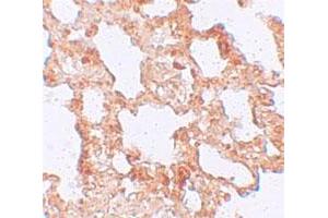 Immunohistochemical staining of rat lung cells with AXIN2 polyclonal antibody  at 5 ug/mL. (AXIN2 antibody  (C-Term))