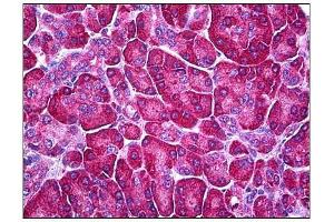 Human Pancreas: Formalin-Fixed, Parraffin-Embedded (FFPE) (Ferredoxin Reductase antibody)