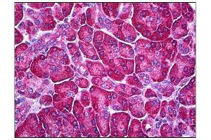 Human Pancreas: Formalin-Fixed, Parraffin-Embedded (FFPE) (Ferredoxin Reductase antibody)