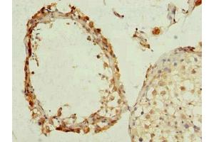 Immunohistochemistry of paraffin-embedded human testis tissue using ABIN7163912 at dilution of 1:100 (KCNRG antibody  (AA 1-229))