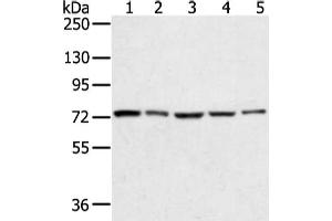 Gel: 6 % SDS-PAGE, Lysate: 40 μg, Lane 1-5: Hela, lncap, skov3, 293T and TM4 cell, Primary antibody: ABIN7131341(TGM4 Antibody) at dilution 1/400 dilution, Secondary antibody: Goat anti rabbit IgG at 1/8000 dilution, Exposure time: 10 seconds (TGM4 antibody)