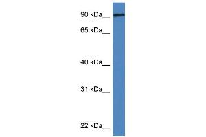 WB Suggested Anti-Dlg3 Antibody   Titration: 1. (DLG3 antibody  (N-Term))