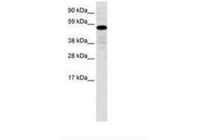 Image no. 1 for anti-Zinc Finger Protein 426 (ZNF426) (AA 70-119) antibody (ABIN6735954) (ZNF426 antibody  (AA 70-119))