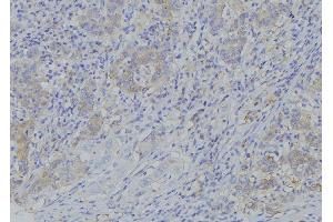 ABIN6273381 at 1/100 staining Human gastric tissue by IHC-P. (PDP2 antibody  (N-Term))