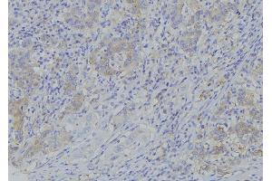 ABIN6273381 at 1/100 staining Human gastric tissue by IHC-P.