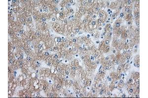 Immunohistochemical staining of paraffin-embedded Human pancreas tissue using anti-RAB17 mouse monoclonal antibody. (RAB17 antibody)