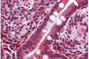 Human Small Intestine (formalin-fixed, paraffin-embedded) stained with TFCP2L1 antibody ABIN462172 followed by biotinylated goat anti-rabbit IgG secondary antibody ABIN481713, alkaline phosphatase-streptavidin and chromogen. (TFCP2L1 antibody  (AA 20-69))