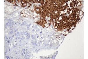 Image no. 2 for anti-Parvin, beta (PARVB) antibody (ABIN1496912) (Parvin, beta antibody)