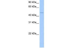 WB Suggested Anti-RBM45 Antibody  Titration: 0.