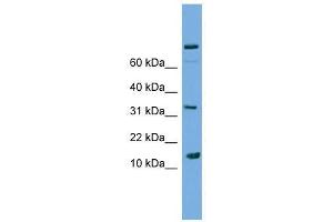 PLA2G2E antibody used at 2. (PLA2G2E antibody  (Middle Region))