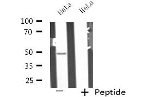 Western blot analysis of extracts from HeLa cells, using PPP2R2B antibody. (PPP2R2B antibody  (Internal Region))