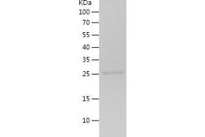 Endothelin 1 Protein (EDN1) (AA 53-90) (His-IF2DI Tag)