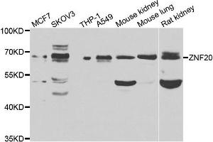 Western blot analysis of extracts of various cell lines, using ZNF20 antibody. (ZNF20 antibody)