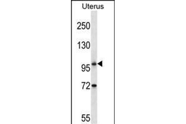 ATG9B antibody  (C-Term)