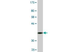 Western Blot detection against Immunogen (35. (NEUROD6 antibody  (AA 246-337))