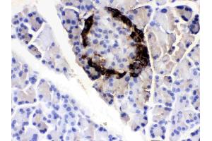 VIP was detected in paraffin-embedded sections of rat pancreas tissues using rabbit anti- VIP Antigen Affinity purified polyclonal antibody (Catalog # ) at 1 µg/mL. (Vip antibody  (Middle Region))