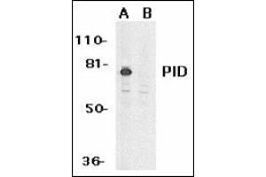 Western blot analysis of PID expression in HeLa whole cell lysates in the absence (A) or presence (B) of blocking peptide with this product at 1 μg /ml. (MTA2 antibody  (AA 652-668))