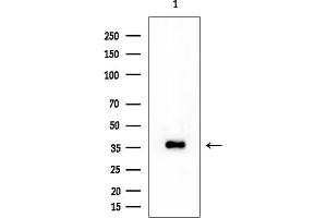 anti-Aspartic Peptidase, Retroviral-Like 1 (ASPRV1) antibody