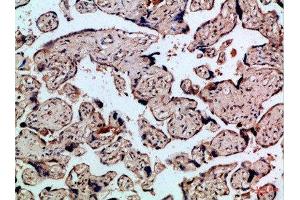 Immunohistochemical analysis of paraffin-embedded Human-placenta, antibody was diluted at 1:100 (FLT4 antibody  (AA 720-760))
