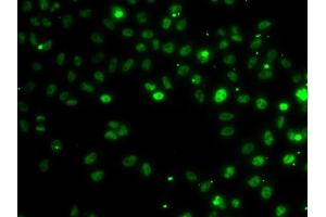 Immunofluorescence analysis of MCF-7 cells using RSRC1 antibody (ABIN6131423, ABIN6147283, ABIN6147284 and ABIN6223040). (RSRC1 antibody  (AA 117-276))