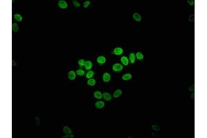 Immunofluorescence staining of HepG2 cells with ABIN7152078 at 1:133, counter-stained with DAPI.
