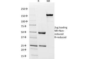 SDS-PAGE Analysis Purified HLA-Pan Mouse Recombinant Monoclonal (rHLA-Pan/3475). (Recombinant MHC Class II HLA-DP/DQ/DR antibody)
