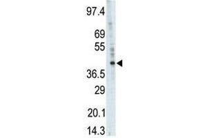 Western blot analysis of anti-PHKG1 Pab in A375 cell lysate. (PHKG1 antibody  (Middle Region))