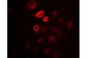 Immunofluorescent analysis of Omentin staining in Hela cells. (ITLN1/Omentin antibody)