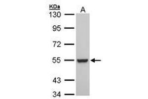 Image no. 1 for anti-Retinoid X Receptor, beta (RXRB) (AA 20-83) antibody (ABIN467472) (Retinoid X Receptor beta antibody  (AA 20-83))