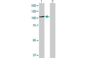 Western Blot analysis of MTHFD1 expression in transfected 293T cell line by MTHFD1 MaxPab polyclonal antibody. (MTHFD1 antibody  (AA 1-935))