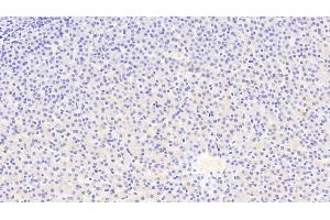 Detection of ATG16L1 in Human Liver Tissue using Polyclonal Antibody to Autophagy Related Protein 16 Like Protein 1 (ATG16L1) (ATG16L1 antibody  (AA 342-607))