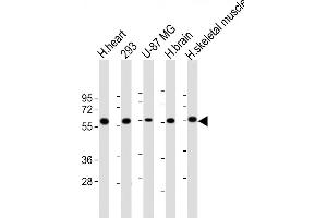 All lanes : Anti-ENTPD2 Antibody at 1:1000 dilution Lane 1: human heart lysate Lane 2: 293 whole cell lysate Lane 3: U-87 MG whole cell lysate Lane 4: human brain lysate Lane 5: human skeletal muscle lysate Lysates/proteins at 20 μg per lane. (ENTPD2 antibody  (N-Term))