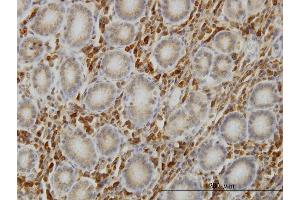 Immunostaining (ISt) image for anti-SHC (Src Homology 2 Domain Containing) Transforming Protein 1 (SHC1) (AA 171-280) antibody (ABIN562866)